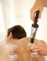 Suction Cupping